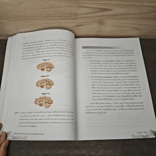 ความรู้พื้นฐานเพื่อการป้องกันและรักษาโรคสมองเสื่อม Alzheimer - วิภาวรรณ ตั้งนิพนธ์ รูปที่ 9