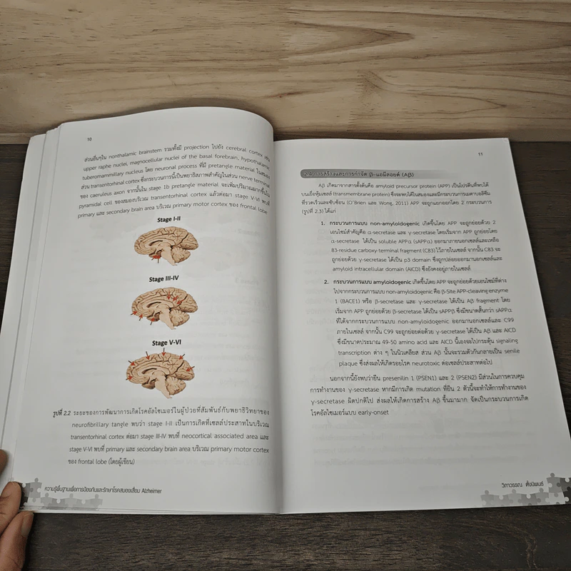 ความรู้พื้นฐานเพื่อการป้องกันและรักษาโรคสมองเสื่อม Alzheimer - วิภาวรรณ ตั้งนิพนธ์ รูปที่ 9