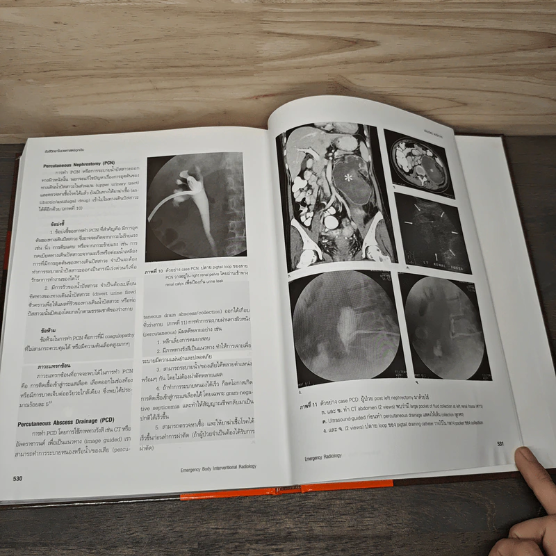 Emergency Radiology รังสีวิทยาในเวชศาสตร์ฉุกเฉิน รูปที่ 9