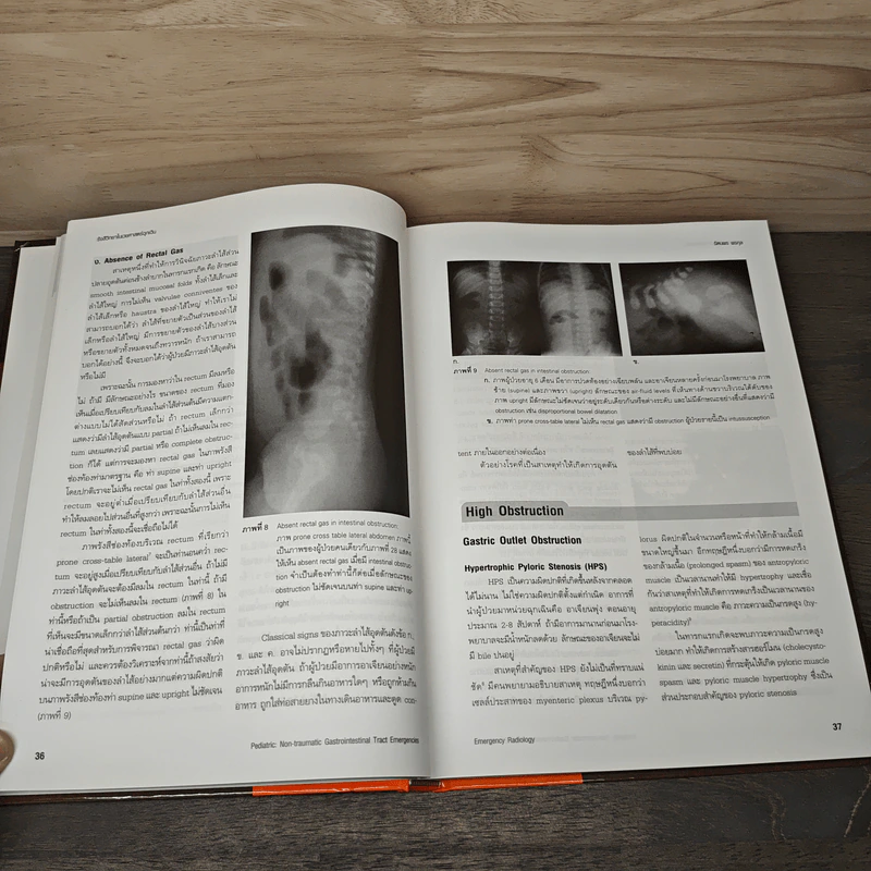 Emergency Radiology รังสีวิทยาในเวชศาสตร์ฉุกเฉิน รูปที่ 8