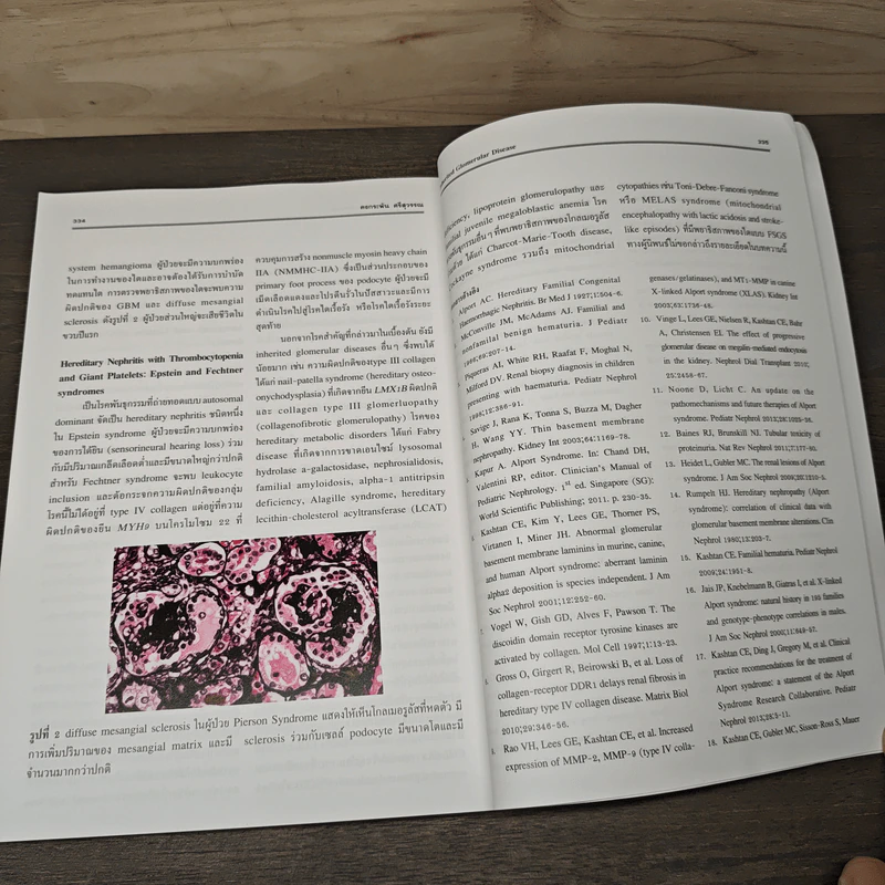 Essentials of Glomerular Disease - บัญชา สถิระพจน์ รูปที่ 8