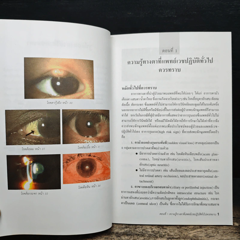 Eye Care For GP. จักษุวิทยา สำหรับเวชปฏิบัติทั้วไป - นพ.ศักดิ์ชัย วงศกิตติรักษ์, นพ.ประภัสร์ ศุขศรีไพศาล รูปที่ 9