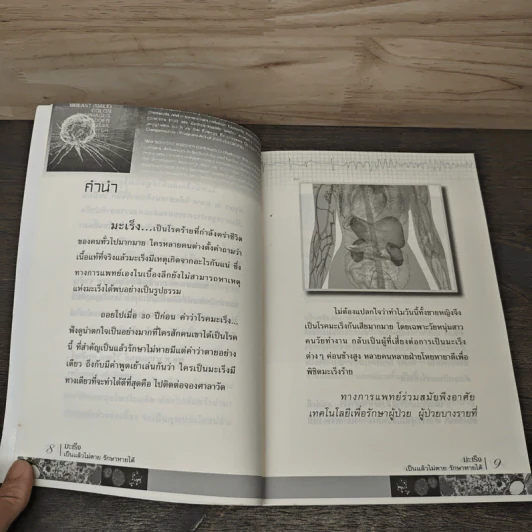 มะเร็งเป็นแล้วไม่ตาย รักษาหายได้ - ราช รามัญ รูปที่ 7