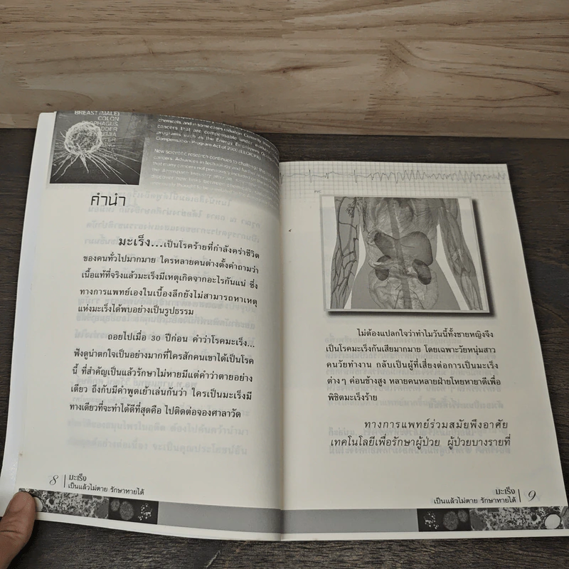 มะเร็งเป็นแล้วไม่ตาย รักษาหายได้ - ราช รามัญ รูปที่ 7
