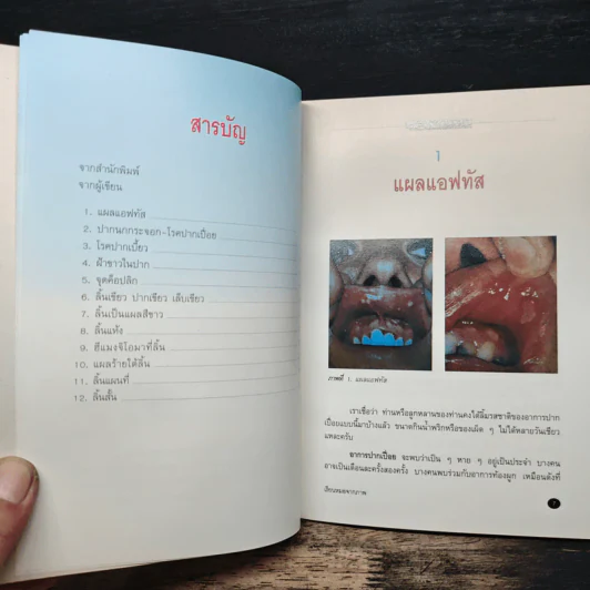 เรียนหมอจากภาพ เล่ม 2 - น.พ.สุรเกียรติ อาชานานุภาพ รูปที่ 7