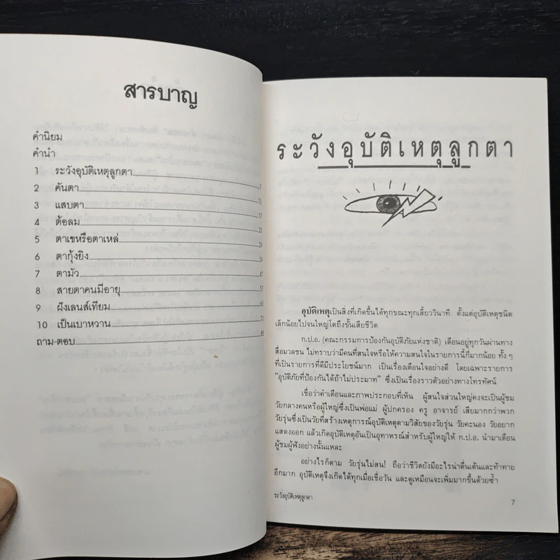ดวงตาน่าถนอม เล่ม 2 - นายแพทย์สุรพงษ์ ดวงรัตน์ รูปที่ 7