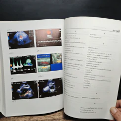 Ultrasound in Clinical Practice การวินิจฉัยด้วยคลื่นเสียงความถี่สูง - สาโรจน์ วรรณพฤกษ์, อรสา ชวาลภาฤทธิ์ รูปที่ 9