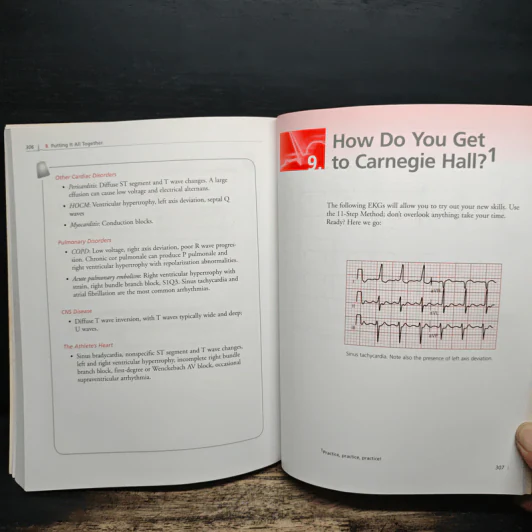 The Only EKG Book You'll Ever Need - Malcolm S. Thaler รูปที่ 11