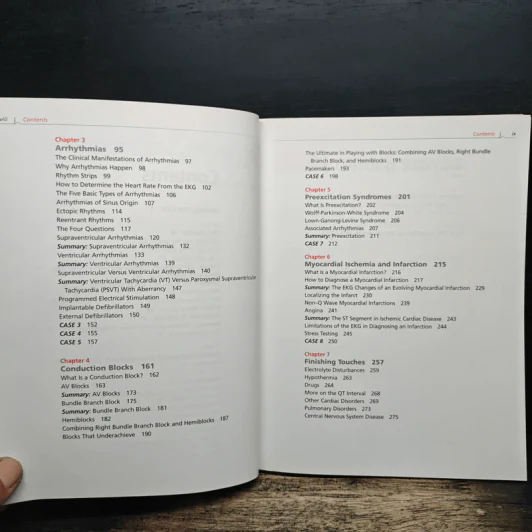 The Only EKG Book You'll Ever Need - Malcolm S. Thaler รูปที่ 7