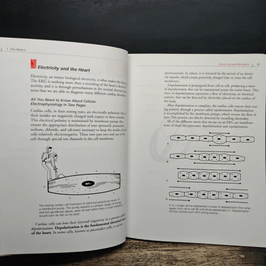 The Only EKG Book You'll Ever Need - Malcolm S. Thaler รูปที่ 10