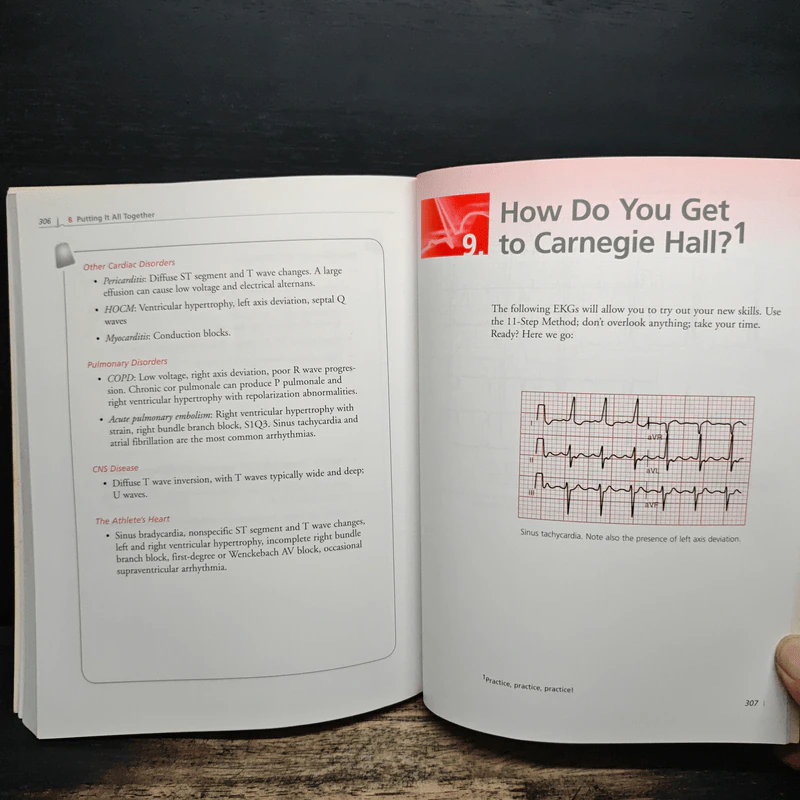 The Only EKG Book You'll Ever Need - Malcolm S. Thaler รูปที่ 11