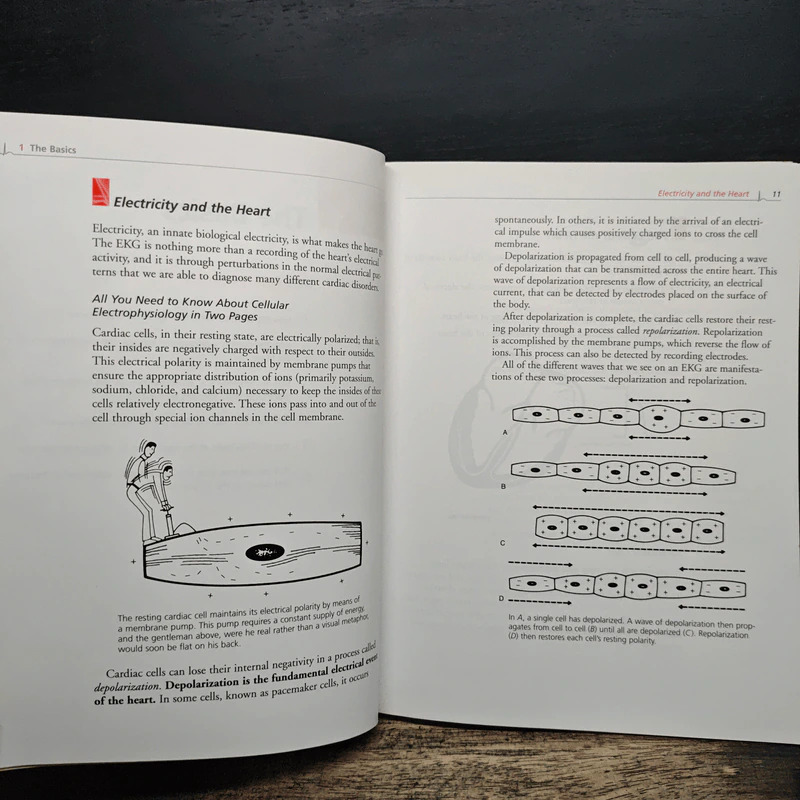 The Only EKG Book You'll Ever Need - Malcolm S. Thaler รูปที่ 10