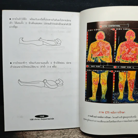 108 คำถามกับดุลยภาพบำบัด - พ.ญ.ลดาวัลย์ สุวรรณกดิตติ รูปที่ 9