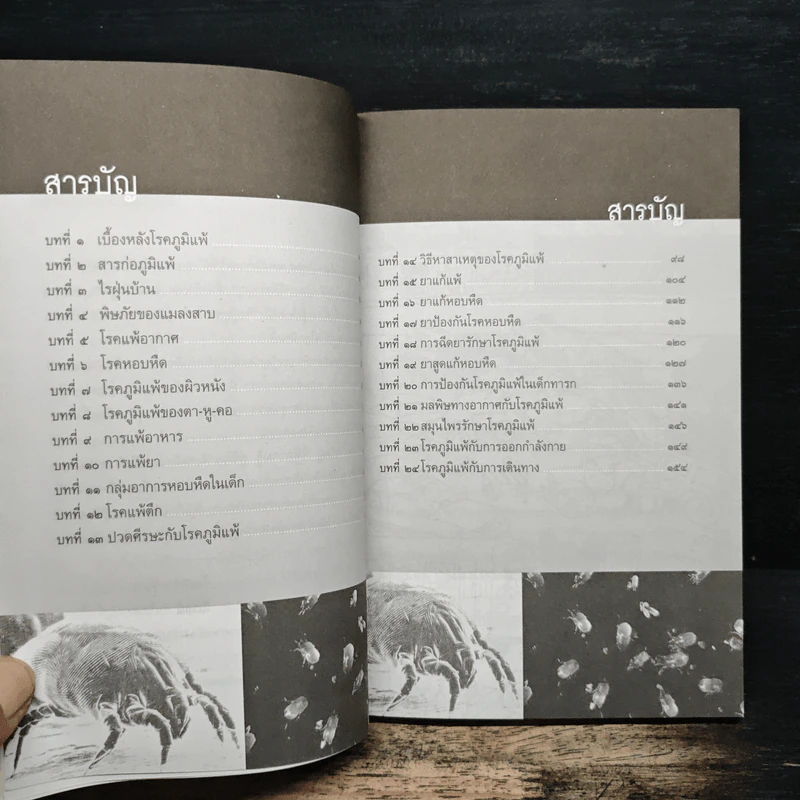 รู้เรื่องโรคภูมิแพ้ ป้องกันได้ รักษาหาย - พ.ต.อ.นพ.พิพัฒน์ ชูวรเวช, พ.ต.อ.พญ.นพมาศ ชูวรเวช รูปที่ 7