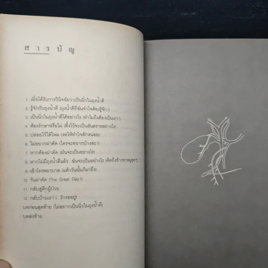 นิ่วในถุงน้ำดี - รองศาสตราจารย์นายแพทย์พัฒน์พงศ์ นาวีเจริญ รูปที่ 7