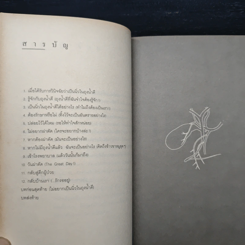 นิ่วในถุงน้ำดี - รองศาสตราจารย์นายแพทย์พัฒน์พงศ์ นาวีเจริญ รูปที่ 7