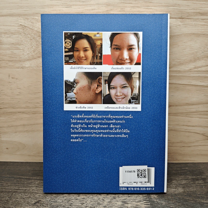 สิว...ซีเคร็ต Plus เล่ม 1 - ริญญาภัทร์ หอมลา รูปที่ 5