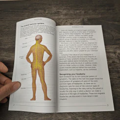 Understanding Migraine & Other Headaches - Anne MacGregor รูปที่ 7