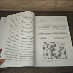 โรคมะเร็งเม็ดเลือดขาวในเด็ก Childhood Leukemia - สามารถ ภคกษมา รูปที่ 7