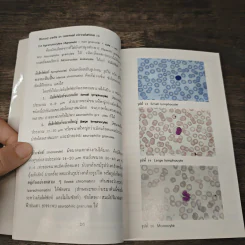 โลหิตวิทยา Hematology - สุภินันท์ สเป็ค-สายเชื้อ รูปที่ 8