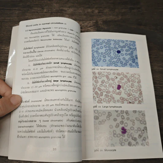 โลหิตวิทยา Hematology - สุภินันท์ สเป็ค-สายเชื้อ รูปที่ 8