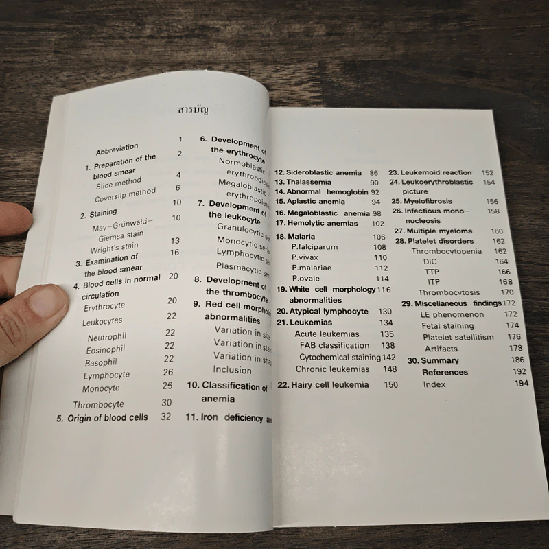 โลหิตวิทยา Hematology - สุภินันท์ สเป็ค-สายเชื้อ รูปที่ 7