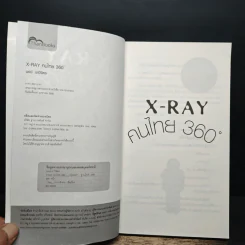 X-Ray คนไทย 360 ํ - พงษ์ ผาวิจิตร รูปที่ 6