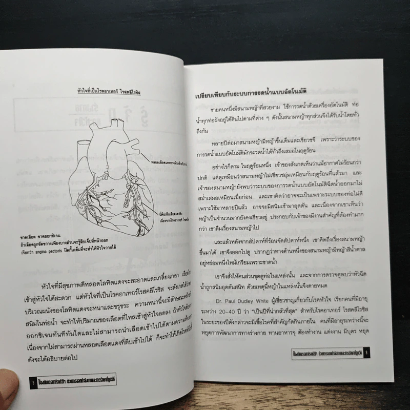 ป้องกัน บรรเทา โรคหัวใจ ด้วยการออกกำลังกายและการรักษาที่ถูกวิธี - นายแพทย์วสันต์ อุตตมะกานนท์ รูปที่ 8