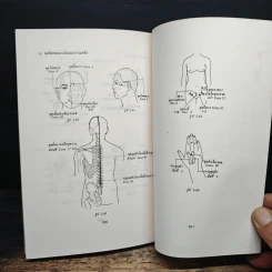 แทงเข็ม - อภิชัย ขัยดรุณ รูปที่ 12
