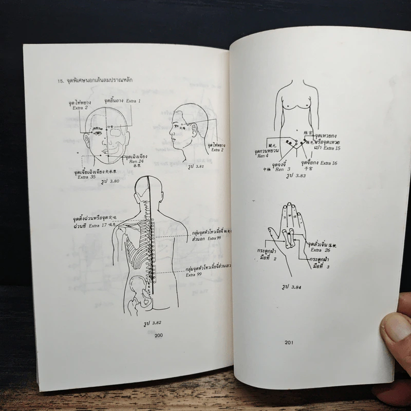แทงเข็ม - อภิชัย ขัยดรุณ รูปที่ 12