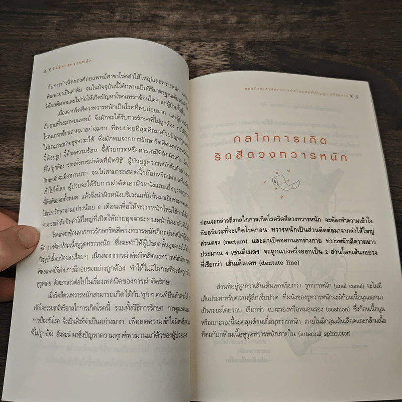 ริดสีดวงทวารหนัก - พลตรี รองศาสตราจารย์, นายแพทย์ปริญญา ทวีชัยการ รูปที่ 9