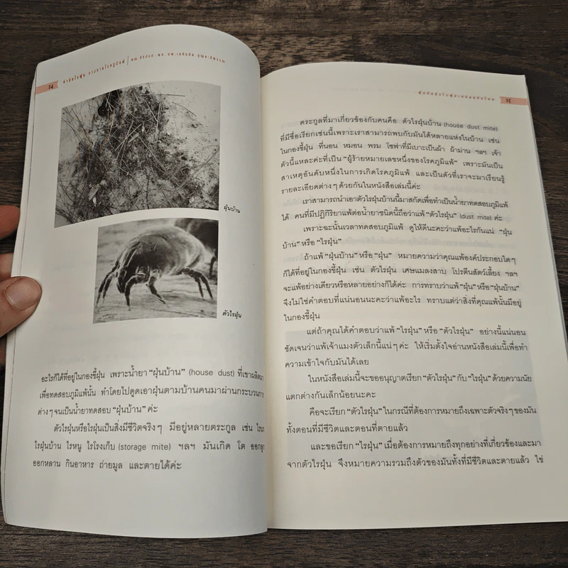กำจัดไรฝุ่น ทางหายโรคภูมิแพ้ - แพทย์หญิงสิรินันท์ บุญยะลีพรรณ รูปที่ 9