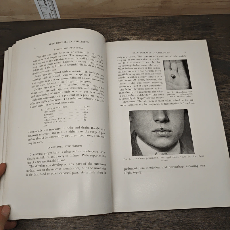 Skin Diseases in Children - George M. MacKee, M.D., Anthony C. Cipollaro, M.D. รูปที่ 9