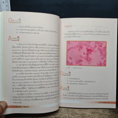 ปริศนาคลินิก โรคติดเชื้อ - นายแพทย์สมนึก สังขนาภา รูปที่ 10