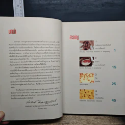 โรคติดต่อทางเพศสัมพันธ์ระหว่างตั้งครรภ์ - รองศาสตราจารย์ นายแพทย์ประทักษ์ โอประเสริฐสวัสดิ์ รูปที่ 7