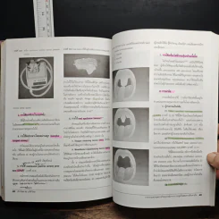 ตำราโสต ศอ นาสิกวิทยา - สุภาวดี ประคุณหังสิต, สมยศ คุณจักร รูปที่ 13