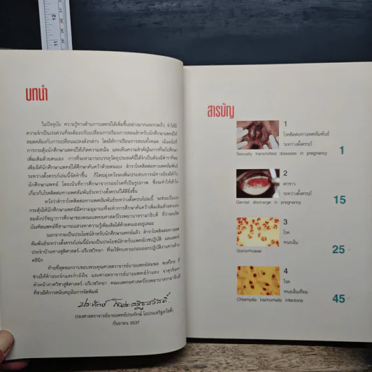 โรคติดต่อทางเพศสัมพันธ์ระหว่างตั้งครรภ์ - รองศาสตราจารย์ นายแพทย์ประทักษ์ โอประเสริฐสวัสดิ์ รูปที่ 7