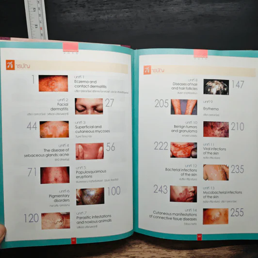 Dermatology 2010 ตำราโรคผิวหนังในเวชปฏิบัติปัจจุบัน รูปที่ 8