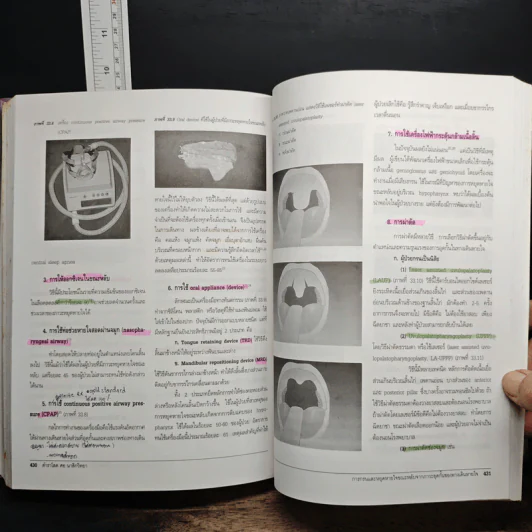 ตำราโสต ศอ นาสิกวิทยา - สุภาวดี ประคุณหังสิต, สมยศ คุณจักร รูปที่ 13