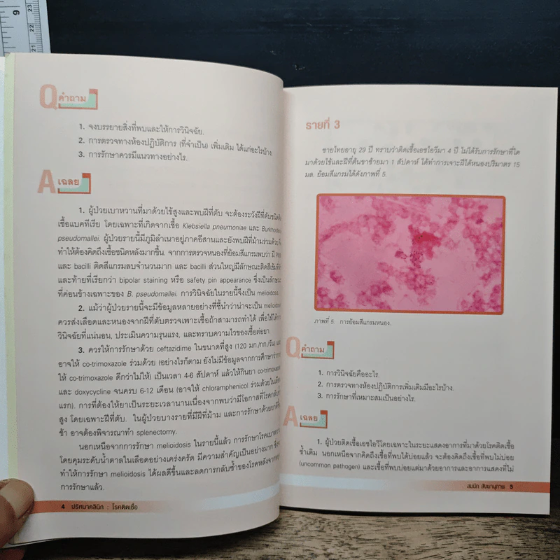 ปริศนาคลินิก โรคติดเชื้อ - นายแพทย์สมนึก สังขนาภา รูปที่ 10