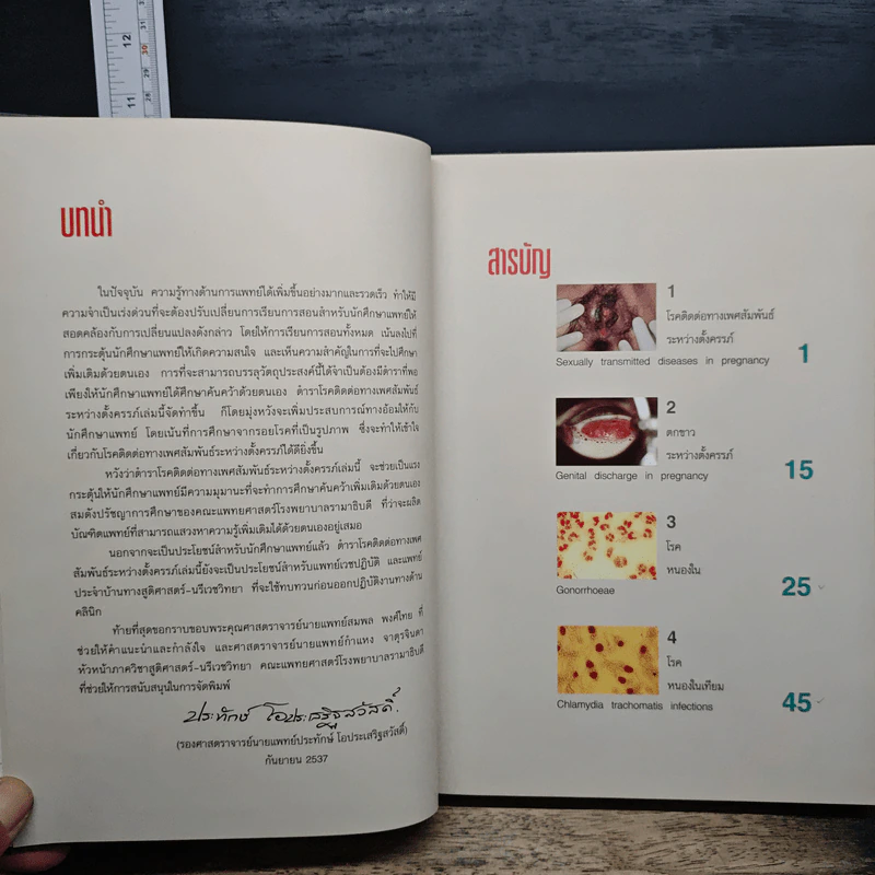 โรคติดต่อทางเพศสัมพันธ์ระหว่างตั้งครรภ์ - รองศาสตราจารย์ นายแพทย์ประทักษ์ โอประเสริฐสวัสดิ์ รูปที่ 7