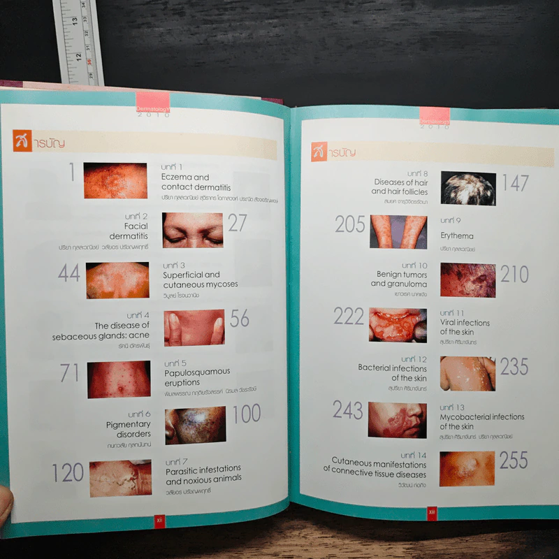 Dermatology 2010 ตำราโรคผิวหนังในเวชปฏิบัติปัจจุบัน รูปที่ 8
