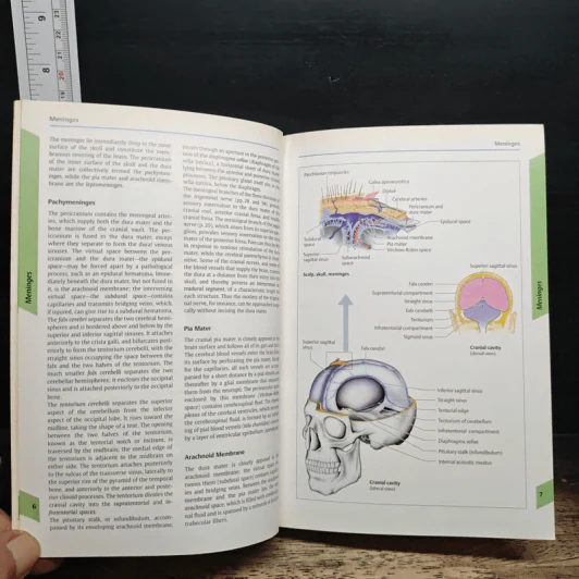 Color Atlas of Neurology รูปที่ 10