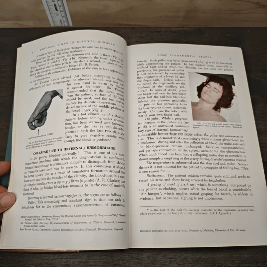 Demonstrations of Physical Signs in Clinical Surgery - Hamilton Bailey รูปที่ 7