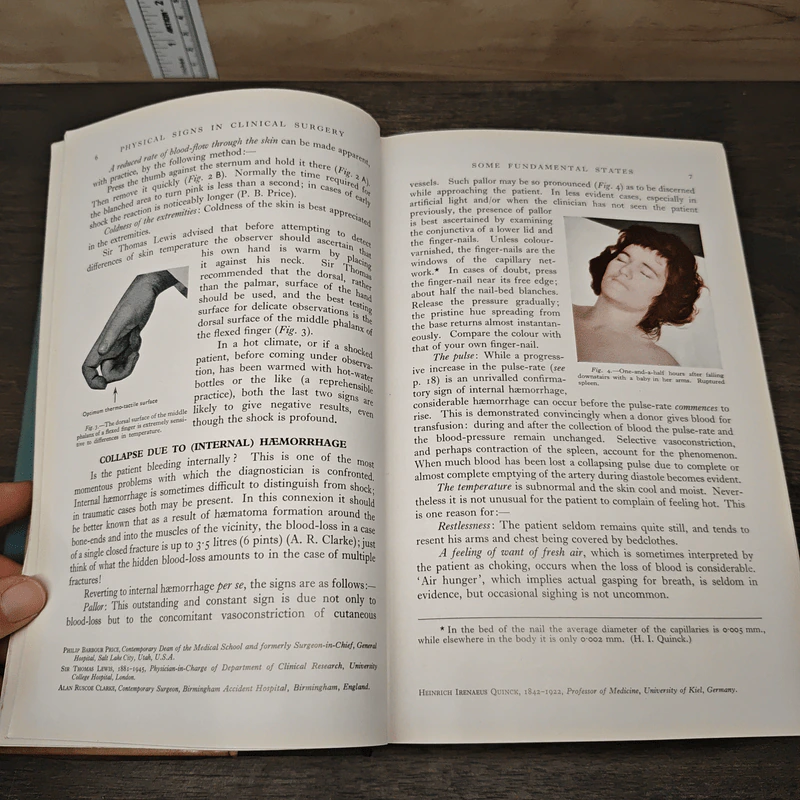 Demonstrations of Physical Signs in Clinical Surgery - Hamilton Bailey รูปที่ 7