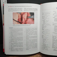 มะเร็งคอหอยหลังโพรงจมูก (Nasopharyngeal Cancer a Multidisciplinary Approach) - รศ.นพ.ชวลิต เลิศบุษยานุกูล รูปที่ 9