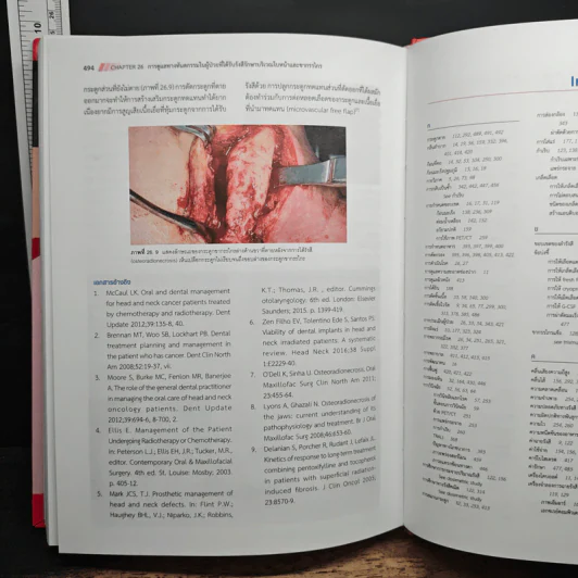 มะเร็งคอหอยหลังโพรงจมูก (Nasopharyngeal Cancer a Multidisciplinary Approach) - รศ.นพ.ชวลิต เลิศบุษยานุกูล รูปที่ 9