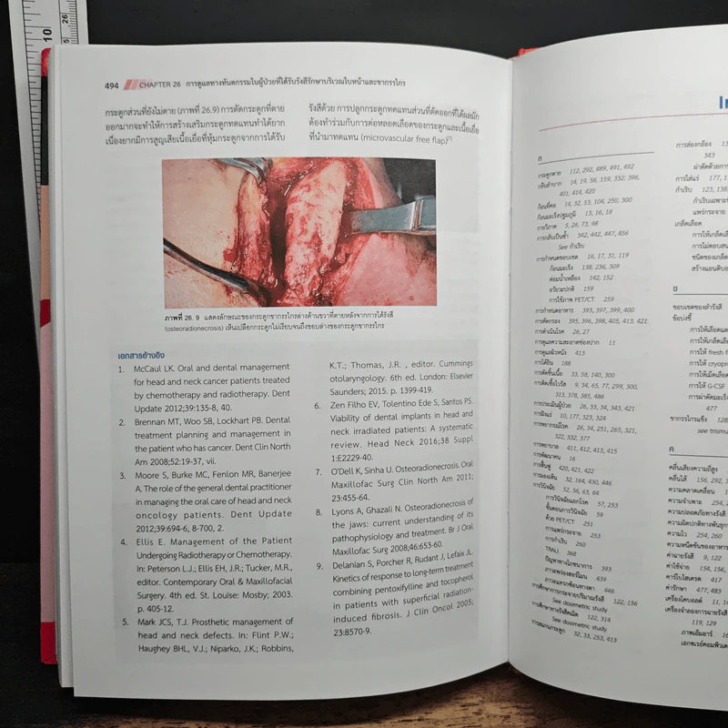 มะเร็งคอหอยหลังโพรงจมูก (Nasopharyngeal Cancer a Multidisciplinary Approach) - รศ.นพ.ชวลิต เลิศบุษยานุกูล รูปที่ 9