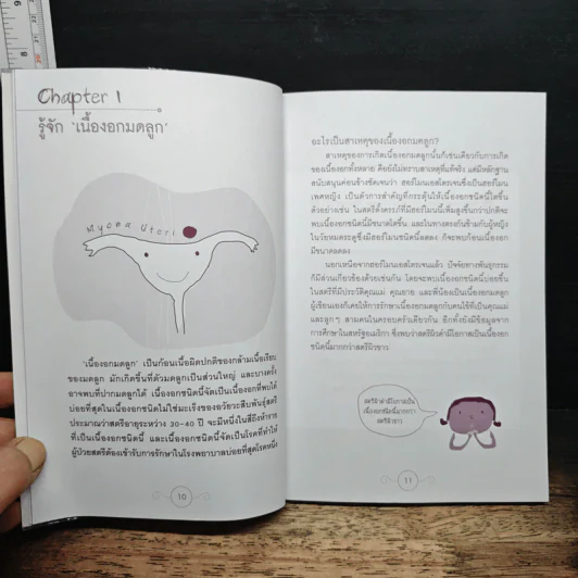 เนื้องอกมดลูก 'ผ่า' 'ไม่ผ่า' - พ.อ. นพ.พิบูลย์ ลีละพัฒนะ รูปที่ 8