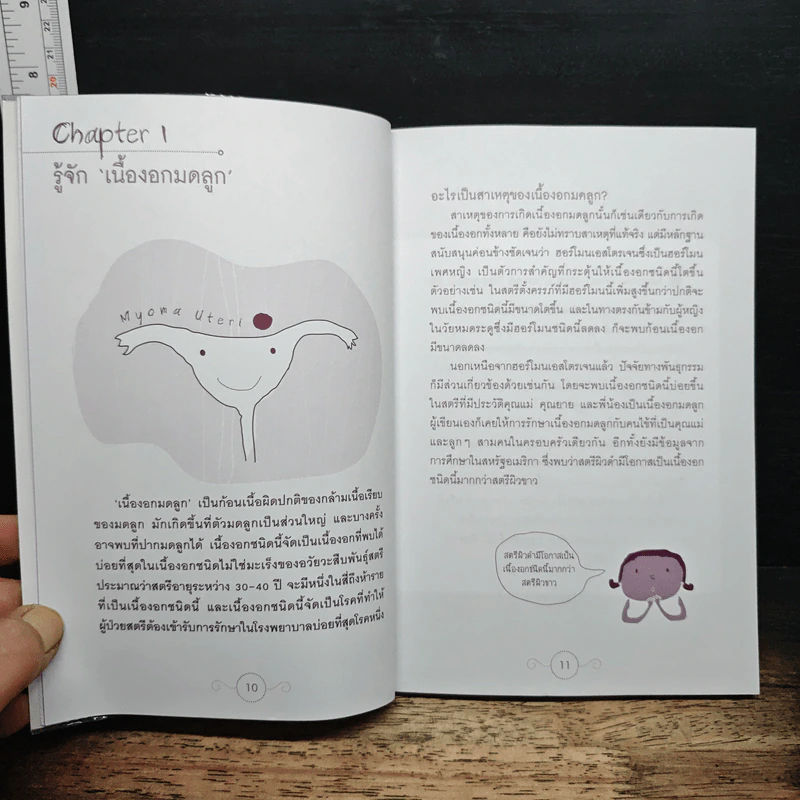 เนื้องอกมดลูก 'ผ่า' 'ไม่ผ่า' - พ.อ. นพ.พิบูลย์ ลีละพัฒนะ รูปที่ 8